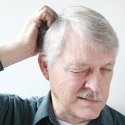 senior man scratches his itchy scalp